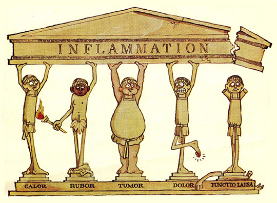 İnflammation